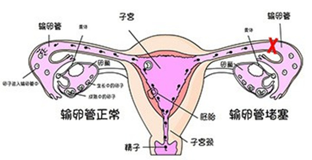 输卵管2.jpg